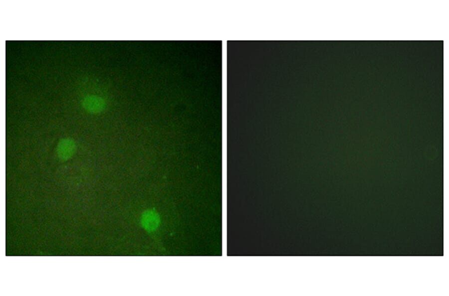 Immunofluorescence - Anti-AurB Antibody (B1021) - Antibodies.com