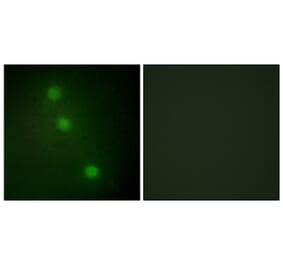 Immunofluorescence - Anti-ATF1 Antibody (C10419) - Antibodies.com