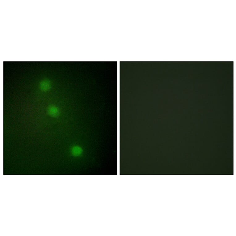 Immunofluorescence - Anti-ATF1 Antibody (C10419) - Antibodies.com