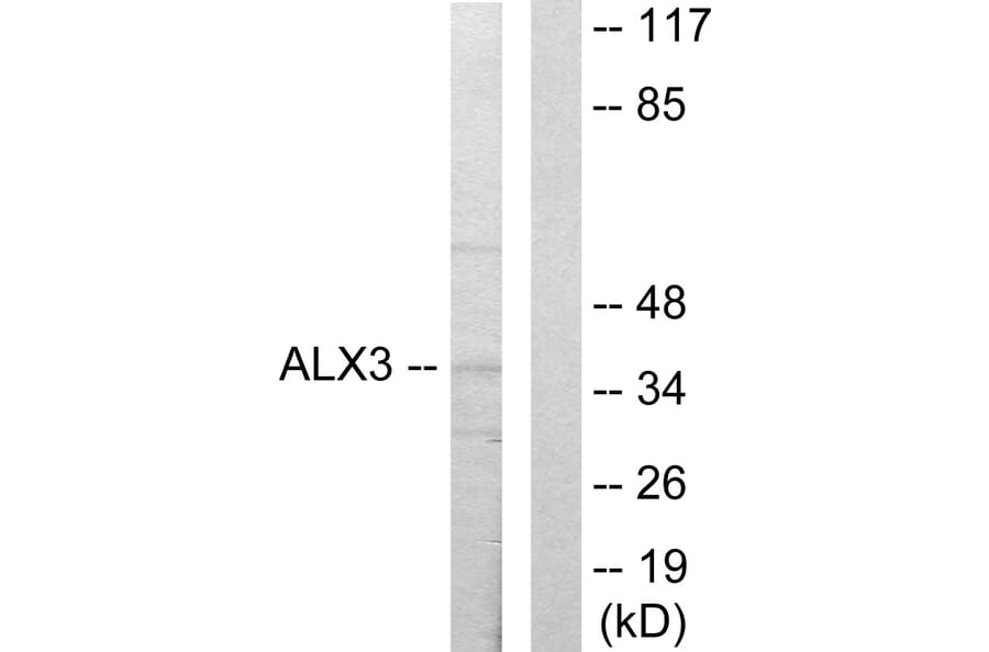 Western Blot - Anti-ALX3 Antibody (C10213) - Antibodies.com