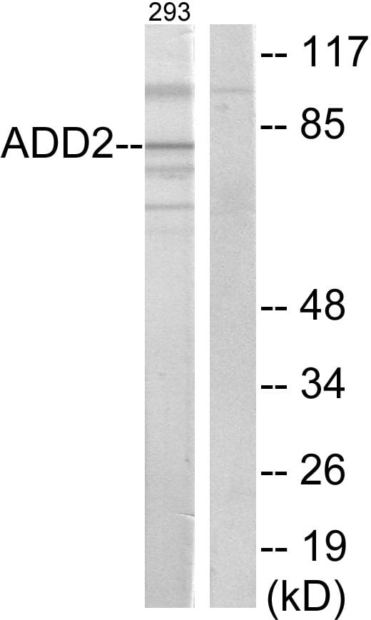 Western blot analysis of lysates from 293 cells using Anti-ADD2 Antibody. The right hand lane represents a negative control, where the antibody is blocked by the immunising peptide.