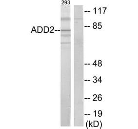 Western Blot - Anti-ADD2 Antibody (C12041) - Antibodies.com