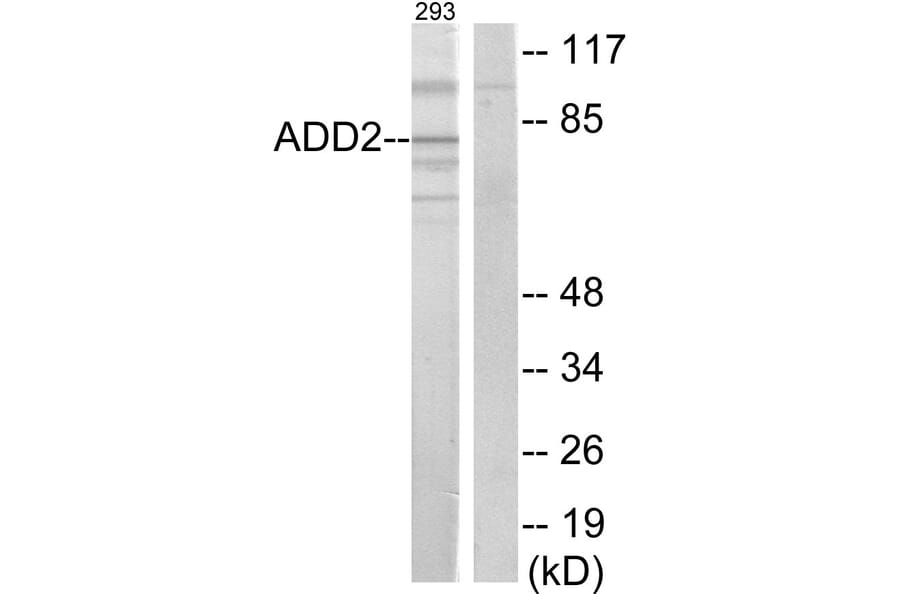 Western Blot - Anti-ADD2 Antibody (C12041) - Antibodies.com