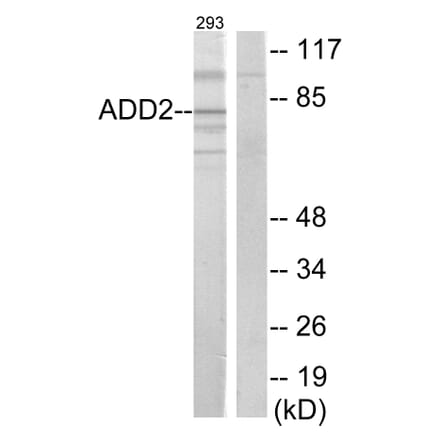 Western Blot - Anti-ADD2 Antibody (C12041) - Antibodies.com