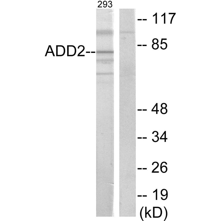 Western Blot - Anti-ADD2 Antibody (C12041) - Antibodies.com