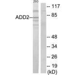 Western Blot - Anti-ADD2 Antibody (C12041) - Antibodies.com