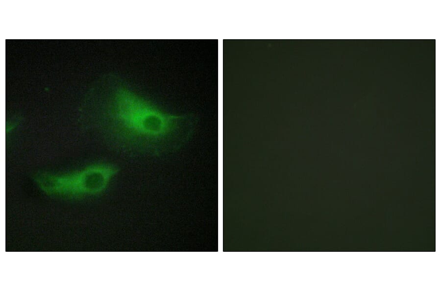 Immunofluorescence - Anti-ADD2 Antibody (C12041) - Antibodies.com