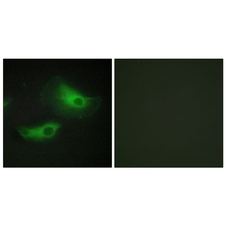 Immunofluorescence - Anti-ADD2 Antibody (C12041) - Antibodies.com