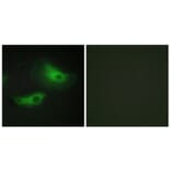 Immunofluorescence - Anti-ADD2 Antibody (C12041) - Antibodies.com