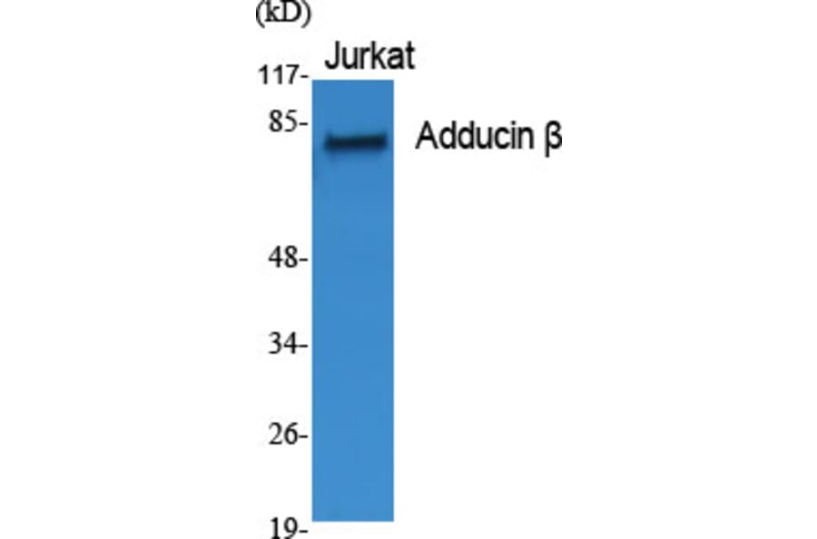 Western Blot - Anti-ADD2 Antibody (C12041) - Antibodies.com