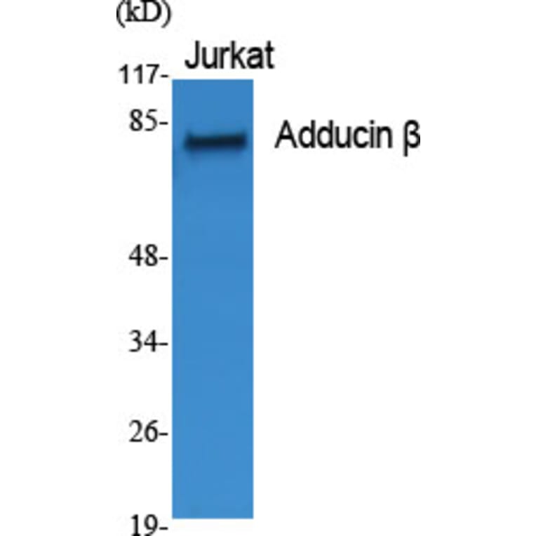Western Blot - Anti-ADD2 Antibody (C12041) - Antibodies.com
