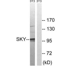 Western Blot - Anti-MER Antibody (B8138) - Antibodies.com