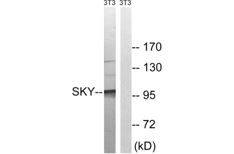 Western Blot - Anti-MER Antibody (B8138) - Antibodies.com
