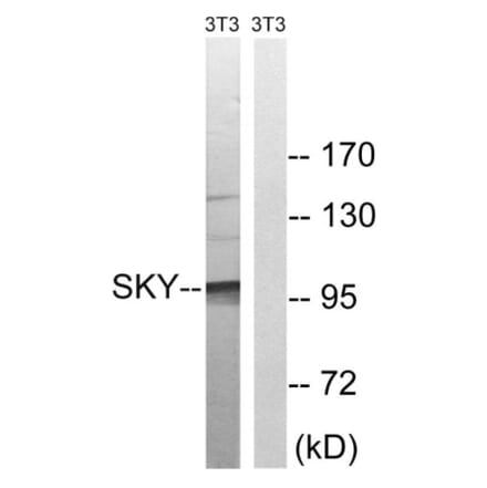 Western Blot - Anti-MER Antibody (B8138) - Antibodies.com
