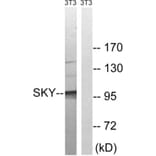 Western Blot - Anti-MER Antibody (B8138) - Antibodies.com