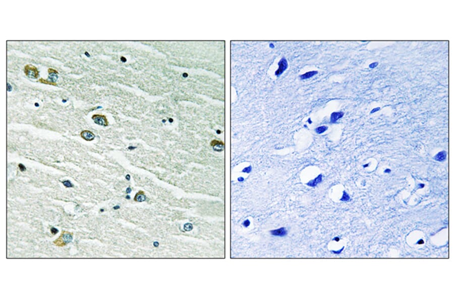 Immunohistochemistry - Anti-MER Antibody (B8138) - Antibodies.com