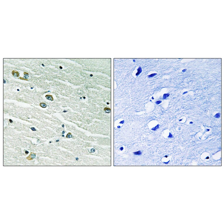 Immunohistochemistry - Anti-MER Antibody (B8138) - Antibodies.com