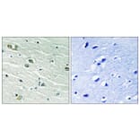 Immunohistochemistry - Anti-MER Antibody (B8138) - Antibodies.com