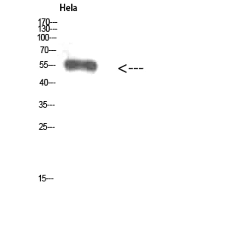 Western Blot - Anti-VIM Antibody (C30875) - Antibodies.com