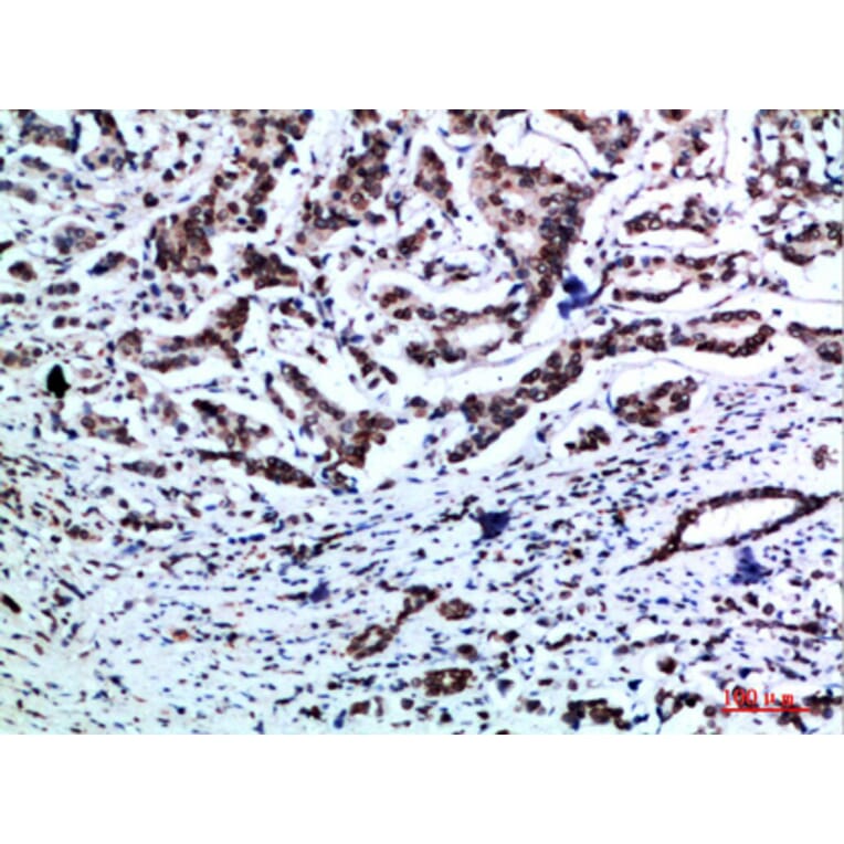 Immunohistochemistry - Anti-VIM Antibody (C30875) - Antibodies.com