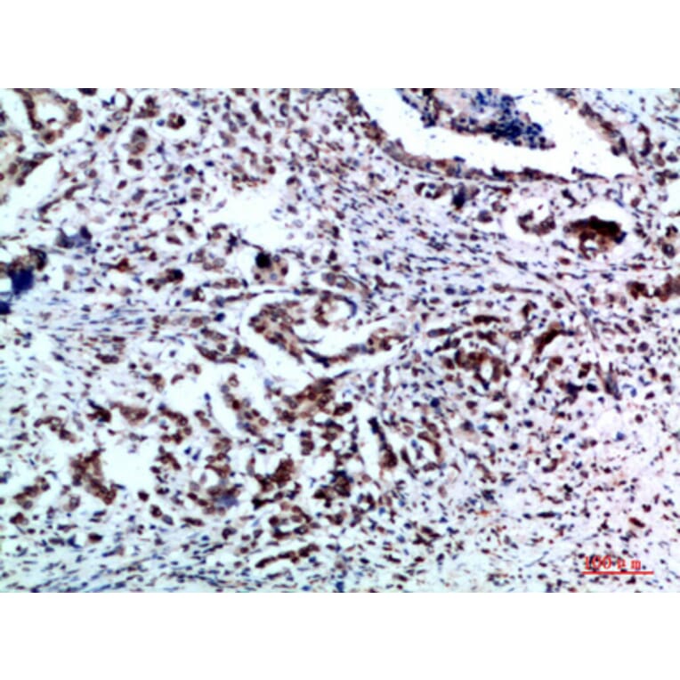 Immunohistochemistry - Anti-VIM Antibody (C30875) - Antibodies.com