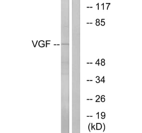 Western Blot - Anti-VGF Antibody (C17031) - Antibodies.com
