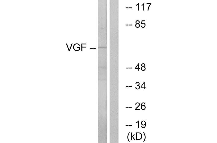 Western Blot - Anti-VGF Antibody (C17031) - Antibodies.com