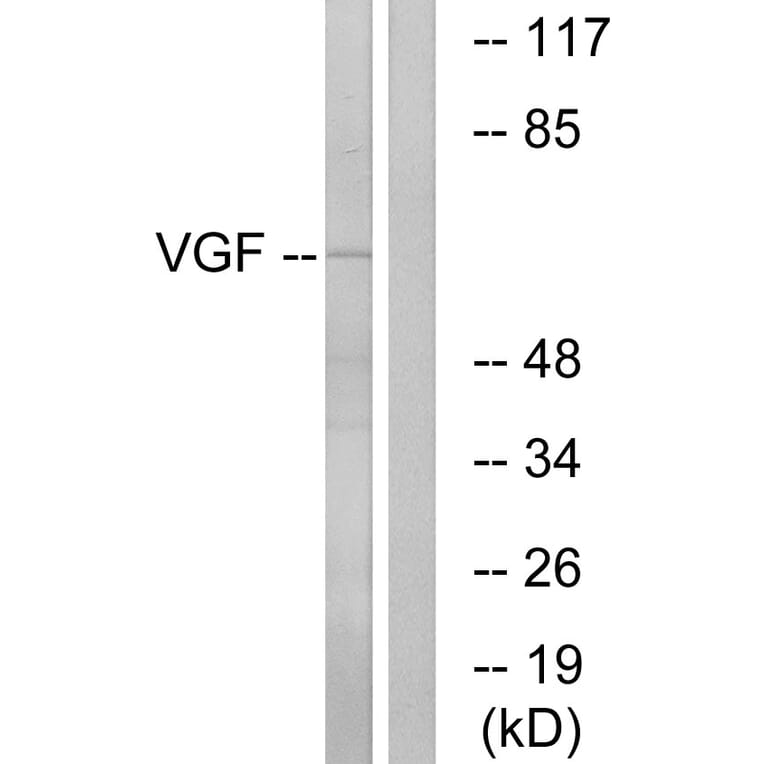 Western Blot - Anti-VGF Antibody (C17031) - Antibodies.com