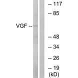 Western Blot - Anti-VGF Antibody (C17031) - Antibodies.com