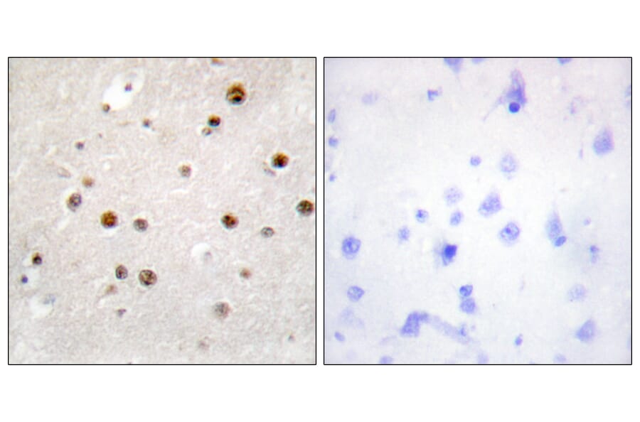 Immunohistochemistry - Anti-TSN Antibody (C11090) - Antibodies.com