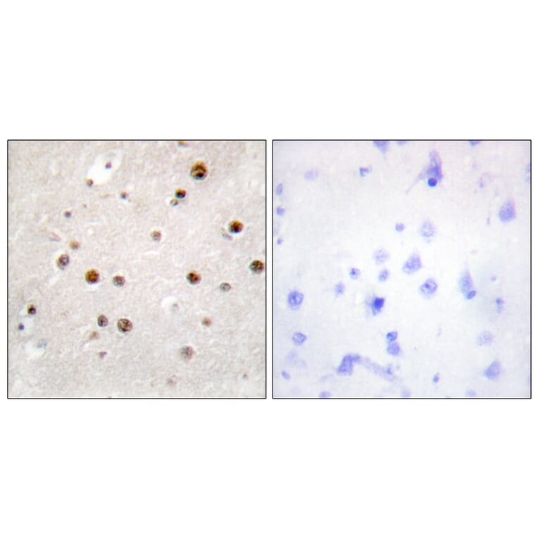 Immunohistochemistry - Anti-TSN Antibody (C11090) - Antibodies.com