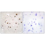 Immunohistochemistry - Anti-TSN Antibody (C11090) - Antibodies.com