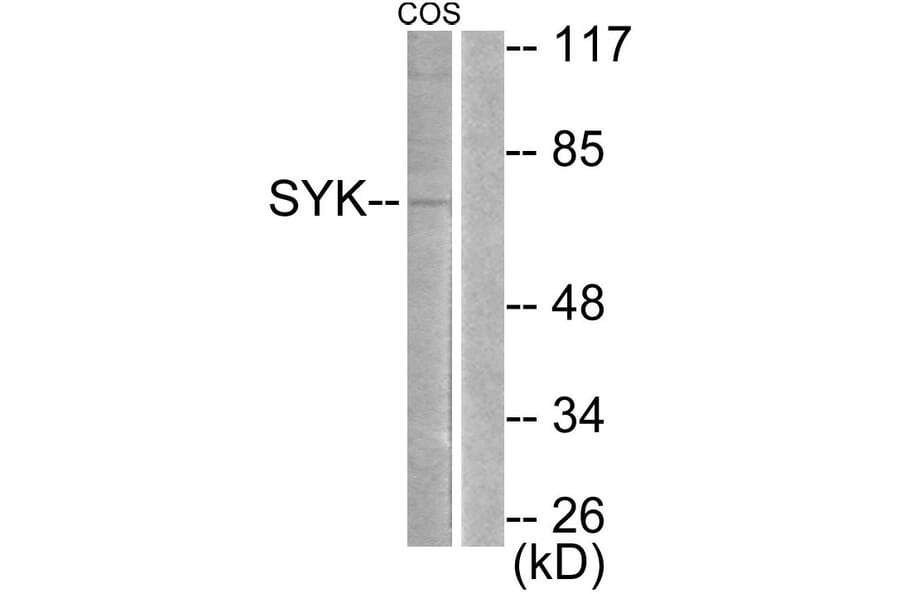 Western Blot - Anti-SYK Antibody (B0092) - Antibodies.com