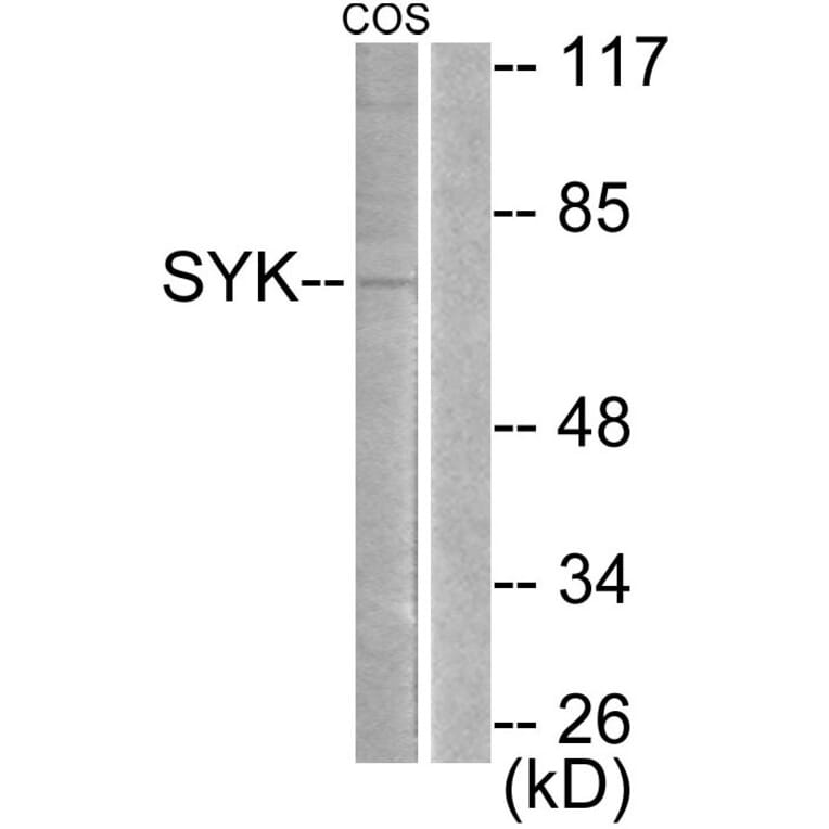 Western Blot - Anti-SYK Antibody (B0092) - Antibodies.com