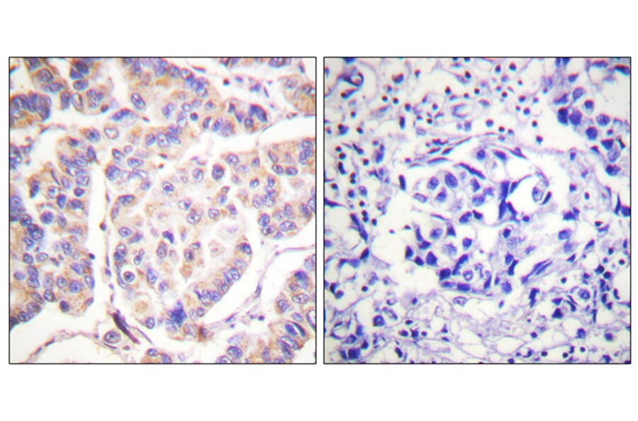 Immunohistochemistry - Anti-SYK Antibody (B0092) - Antibodies.com