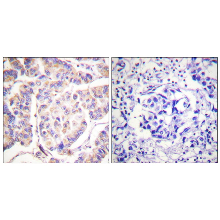 Immunohistochemistry - Anti-SYK Antibody (B0092) - Antibodies.com