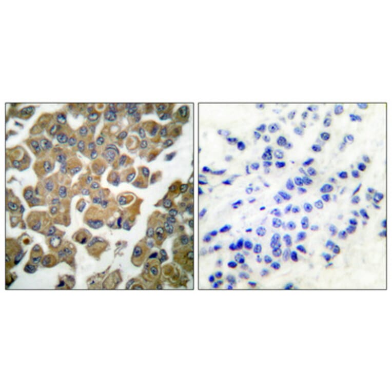 Immunohistochemistry - Anti-SYK Antibody (B0092) - Antibodies.com