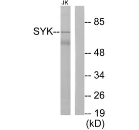 Western Blot - Anti-SYK Antibody (B0091) - Antibodies.com