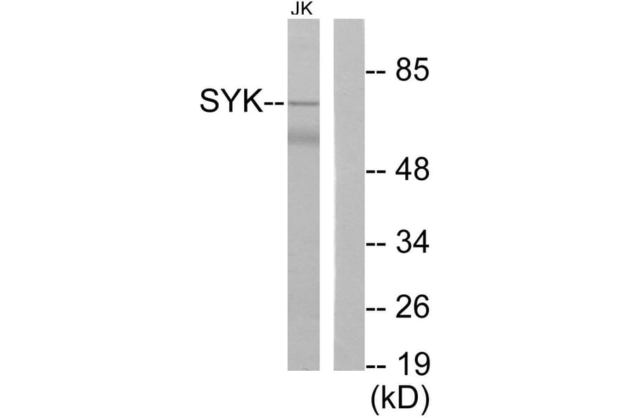 Western Blot - Anti-SYK Antibody (B0091) - Antibodies.com