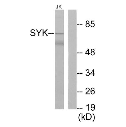 Western Blot - Anti-SYK Antibody (B0091) - Antibodies.com