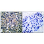 Immunohistochemistry - Anti-SYK Antibody (B0091) - Antibodies.com