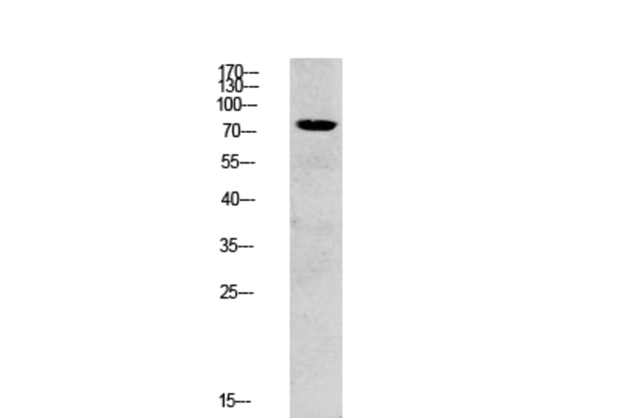 Western Blot - Anti-SYK Antibody (B0091) - Antibodies.com