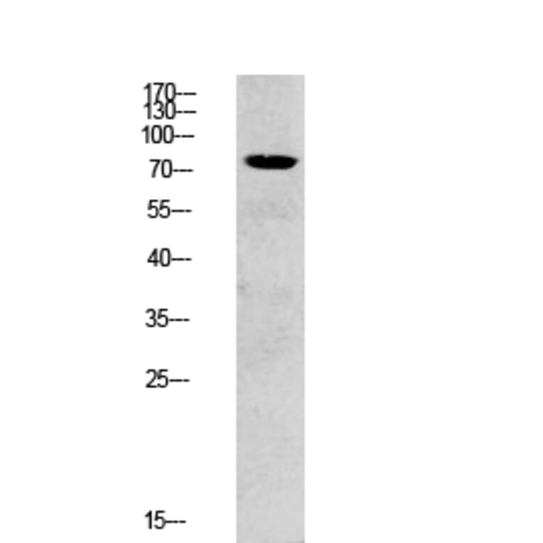 Western Blot - Anti-SYK Antibody (B0091) - Antibodies.com