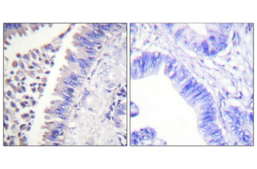 Immunohistochemistry - Anti-SYK Antibody (B0091) - Antibodies.com