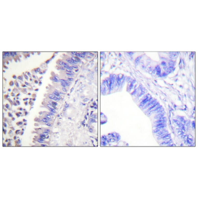 Immunohistochemistry - Anti-SYK Antibody (B0091) - Antibodies.com