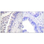 Immunohistochemistry - Anti-SYK Antibody (B0091) - Antibodies.com