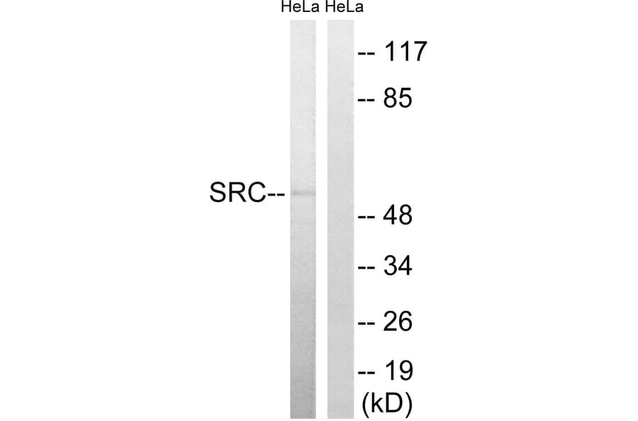 Western Blot - Anti-Src Antibody (B8186) - Antibodies.com