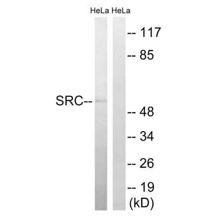 Western Blot - Anti-Src Antibody (B8186) - Antibodies.com