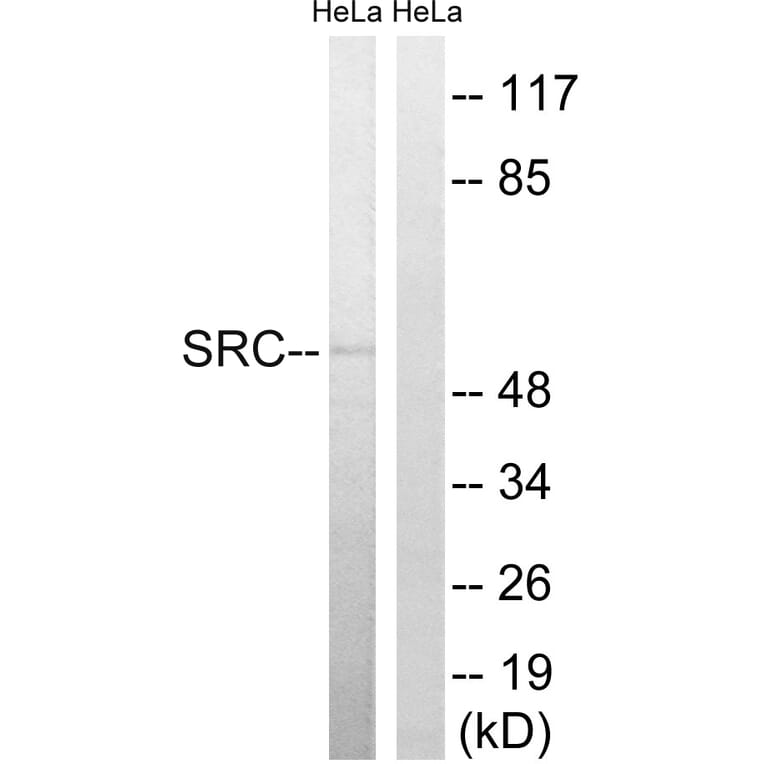 Western Blot - Anti-Src Antibody (B8186) - Antibodies.com