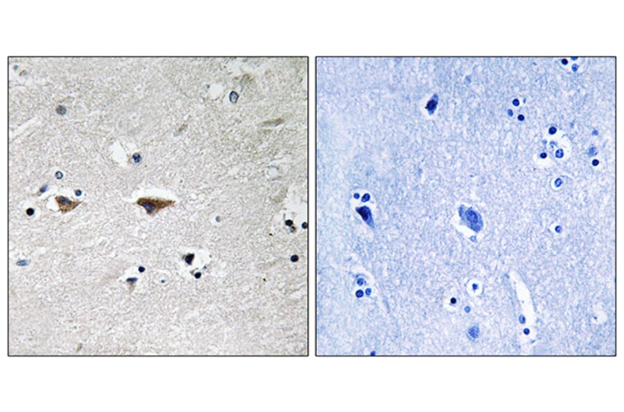 Immunohistochemistry - Anti-Src Antibody (B8186) - Antibodies.com
